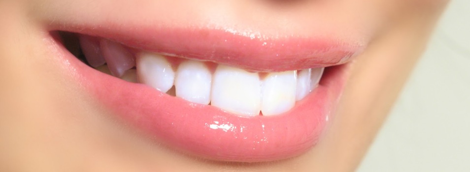 blanquear dientes (1)