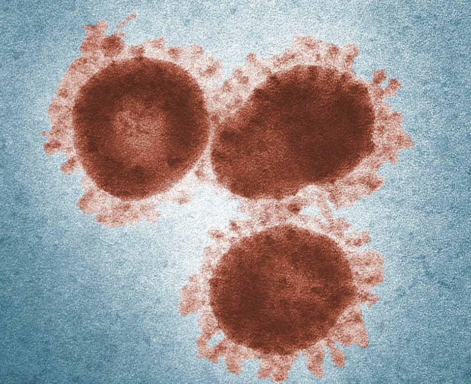 Covid-19: Científicos descubren "punto débil" del virus