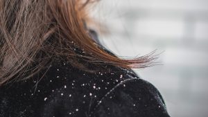 ¿Cómo eliminar la caspa con productos que tenemos en nuestras casas?