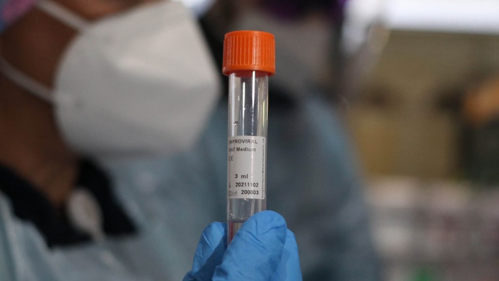 Balance Diarios Casos Coronavirus