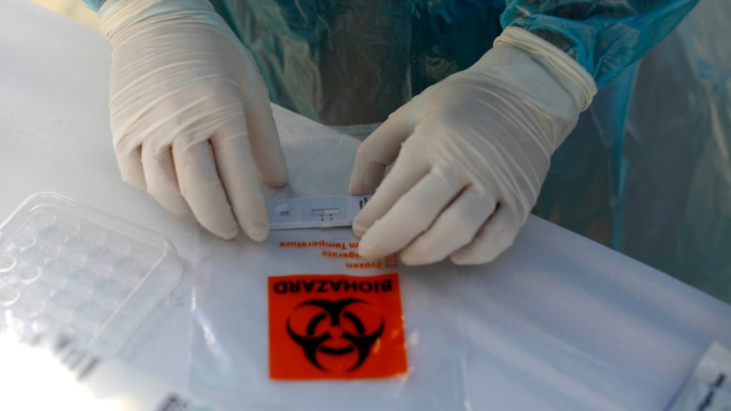 Casos Coronavirus últimas Horas