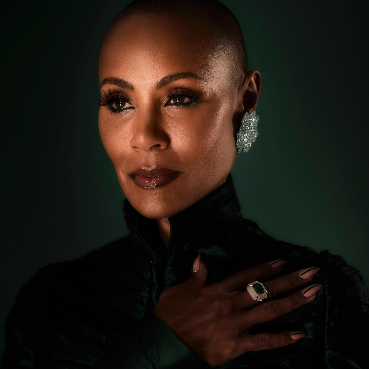 JADA PINKETT ALOPECIA