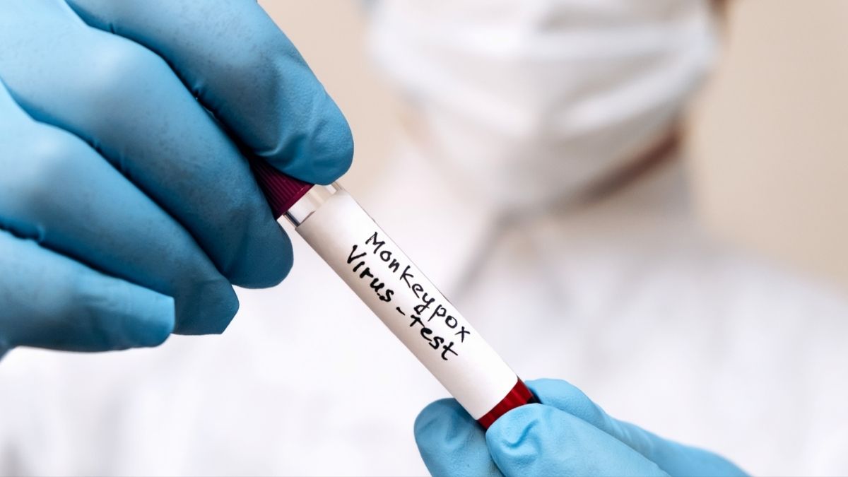 ENFERMEDAD GLOBAL SIMIO (1)