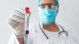 VIRUELA DEL MONO (2)